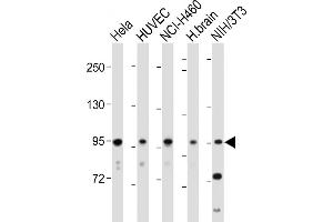 All lanes : Anti-EphA4 Antibody (C-term) at 1:2000 dilution Lane 1: Hela whole cell lysate Lane 2: HUVEC whole cell lysate Lane 3: NCI- whole cell lysate Lane 4: Human brain tissue lysate Lane 5: NIH/3T3 whole cell lysate Lysates/proteins at 20 μg per lane. (EPH Receptor A4 抗体  (C-Term))