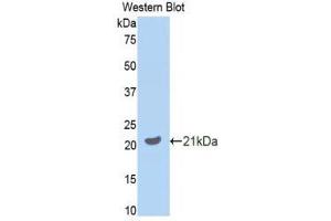 Western Blotting (WB) image for anti-Growth Arrest-Specific 6 (GAS6) (AA 483-646) antibody (ABIN3209083) (GAS6 抗体  (AA 483-646))