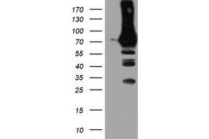 Western Blotting (WB) image for anti-phosphofructokinase, Platelet (PFKP) antibody (ABIN1500164) (PFKP 抗体)