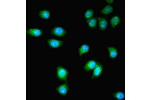 Immunofluorescent analysis of A549 cells using ABIN7163630 at dilution of 1:100 and Alexa Fluor 488-congugated AffiniPure Goat Anti-Rabbit IgG(H+L) (PDGFRB 抗体  (AA 901-1106))