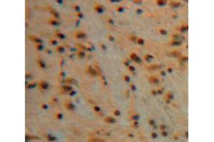 Used in DAB staining on fromalin fixed paraffin-embedded Brain tissue (Erythrocyte Ankyrin 抗体  (AA 32-369))