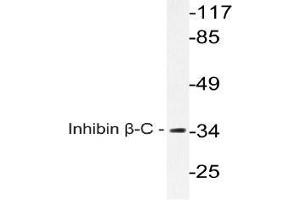 Western blot (WB) analysis of Inhibin beta-C antibody in extracts from A549 cells. (INHBC 抗体)