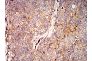 Immunohistochemistry (IHC) image for anti-V-Ral Simian Leukemia Viral Oncogene Homolog B (Ras Related, GTP Binding Protein) (Ralb) (AA 89-206) antibody (ABIN5542685)