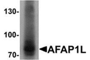 Western blot analysis of AFAP1L1 in A549 cell lysate with AFAP1L1 Cat. (AFAP1L1 抗体  (N-Term))