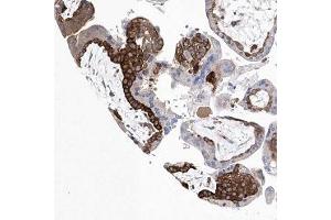 Immunohistochemical staining of human placenta with C14orf100 polyclonal antibody ( Cat # PAB28315 ) shows strong cytoplasmic positivity in trophoblastic cells. (JKAMP 抗体)