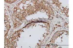 Immunoperoxidase of monoclonal antibody to PIP5K3 on formalin-fixed paraffin-embedded human testis. (PIKFYVE 抗体  (AA 342-451))