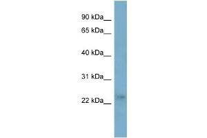 WB Suggested Anti-FTHL17 Antibody Titration:  0.