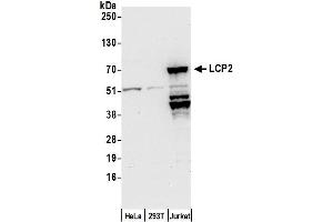 Western Blotting (WB) image for anti-Lymphocyte Cytosolic Protein 2 (SH2 Domain Containing Leukocyte Protein of 76kDa) (LCP2) (AA 225-275) antibody (ABIN7450410)