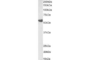 ABIN4902780 (0. (TBXA2R 抗体  (Isoform beta))