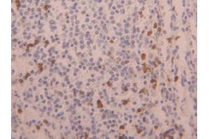 DAB staining on IHC-P; Samples: Human Spleen Tissue (LAMC3 抗体  (AA 1250-1418))