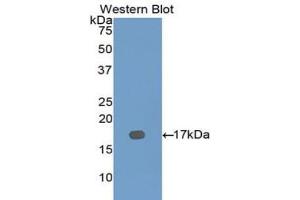 Western blot analysis of the recombinant protein. (Dymeclin 抗体  (AA 546-669))