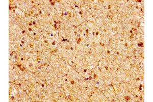 IHC image of ABIN7158074 diluted at 1:100 and staining in paraffin-embedded human brain tissue performed on a Leica BondTM system. (LGI2 抗体  (AA 194-310))