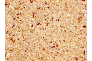 IHC image of ABIN7158074 diluted at 1:100 and staining in paraffin-embedded human brain tissue performed on a Leica BondTM system. (LGI2 抗体  (AA 194-310))