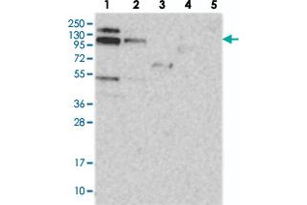 RBM15B anticorps