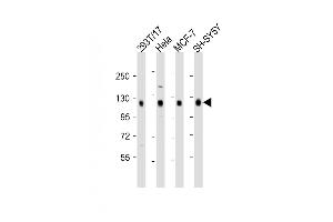 All lanes : Anti-DLG1 Antibody (Center) at 1:2000 dilution Lane 1: 293T/17 whole cell lysate Lane 2: Hela whole cell lysate Lane 3: MCF-7 whole cell lysate Lane 4: SH-SY5Y whole cell lysate Lysates/proteins at 20 μg per lane. (DLG1 抗体  (AA 643-673))