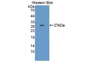 Western blot analysis of the recombinant protein. (DNAJC2 抗体  (AA 442-621))