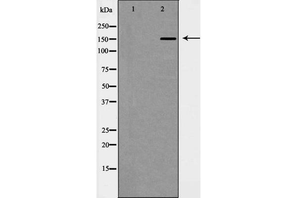 WHSC1L1 抗体  (N-Term)