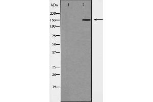 Western blot analysis of Hela cell lysate, using WHSC1L1 Antibody. (WHSC1L1 抗体  (N-Term))