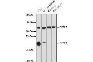Western blot analysis of extracts of various cell lines, using CEBPA antibody ( ABIN6131380, ABIN6138380, ABIN6138381 and ABIN6214018) at 1:1000 dilution. (CEBPA 抗体  (AA 1-205))
