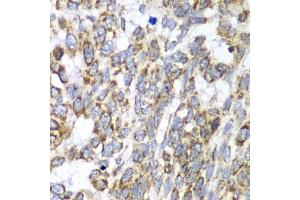 Immunohistochemistry (IHC) image for anti-Dihydrolipoamide S-Succinyltransferase (E2 Component of 2-Oxo-Glutarate Complex) (DLST) (AA 1-290) antibody (ABIN6139665)