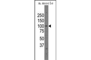 anti-Poly (ADP-Ribose) Polymerase Family, Member 12 (PARP12) (AA 454-483), (C-Term) antibody