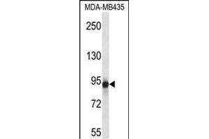 GRM6 Antibody (Center) (ABIN657657 and ABIN2846651) western blot analysis in MDA-M cell line lysates (35 μg/lane). (Metabotropic Glutamate Receptor 6 抗体  (AA 369-398))