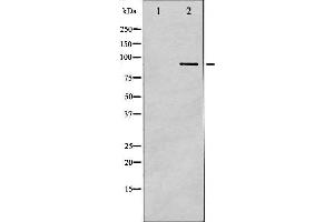 Western Blotting (WB) image for anti-Inhibitor of kappa Light Polypeptide Gene Enhancer in B-Cells, Kinase beta (IKBKB) (pTyr188) antibody (ABIN6256660)