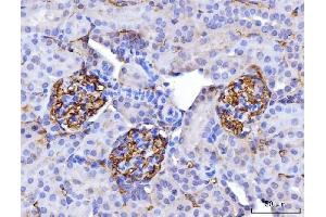 IHC analysis of CD147/Emmprin using anti-CD147/Emmprin antibody (ABIN7599997). (CD147 抗体  (AA 138-323))