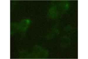 293 cells transfected with C-terminal HA tag protein. (HA-Tag 抗体  (HRP))