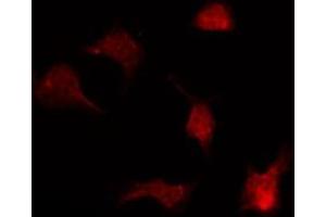 ABIN6267255 staining COS7 by IF/ICC. (ABL1 抗体  (pTyr204))