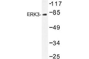 Image no. 1 for anti-Mitogen-Activated Protein Kinase 6 (MAPK6) antibody (ABIN317885) (MAPK6 抗体)