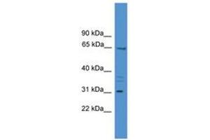 Image no. 1 for anti-Matrix Extracellular phosphoglycoprotein (MEPE) (AA 350-399) antibody (ABIN6745445) (MEPE 抗体  (AA 350-399))