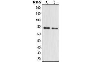 Western blot analysis of MPP10 expression in HeLa (A), MCF7 (B) whole cell lysates. (MPHOSPH10 抗体  (Center))