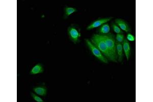 Immunofluorescence staining of A549 cells with ABIN7169337 at 1:150, counter-stained with DAPI. (SERPINB3 抗体  (AA 2-383))
