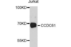 Western blot analysis of extracts of Jurkat cells, using CCDC61 antibody (ABIN5997378) at 1/1000 dilution. (CCDC61 抗体)