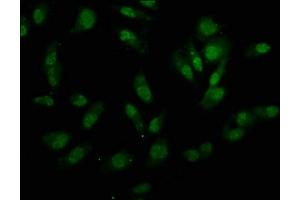 Immunofluorescence staining of Hela cells with ABIN7155342 at 1:133, counter-stained with DAPI. (UTY 抗体  (AA 1-72))