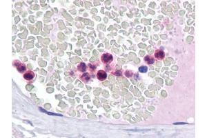 Immunohistochemistry (IHC) image for anti-Interferon Regulatory Factor 4 (IRF4) (AA 342-452) antibody (ABIN614626) (IRF4 抗体  (AA 342-452))