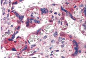 Placenta, Human: Formalin-Fixed, Paraffin-Embedded (FFPE) (COL6 抗体)
