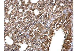 IHC-P Image Dishevelled 3 antibody [N1N2], N-term detects Dishevelled 3 protein at cytoplasm on mouse lung by immunohistochemical analysis. (DVL3 抗体  (N-Term))