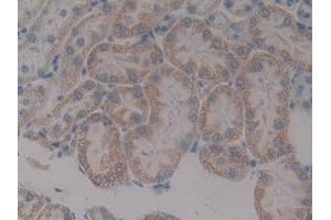 IHC-P analysis of Rat Kidney Tissue, with DAB staining. (Paxillin 抗体  (AA 327-568))