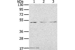 Western blot analysis of Jurkat, K562 and 293T cell, using FOXG1  Polyclonal Antibody at dilution of 1:200 (FOXG1 抗体)