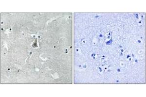 Immunohistochemistry analysis of paraffin-embedded human brain, using Bax (Phospho-Ser184) Antibody. (BAX 抗体  (pSer184))