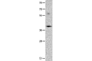 Western blot analysis of Mouse brain tissue, using OPCML Polyclonal Antibody at dilution of 1:400 (OPCML 抗体)