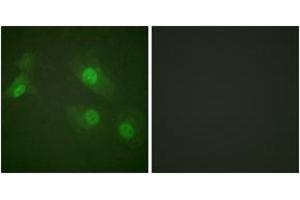 Immunofluorescence analysis of HeLa cells treated with EGF 200nM 5', using NF-kappaB p105/p50 (Phospho-Ser927) Antibody. (NFKB1 抗体  (pSer927))