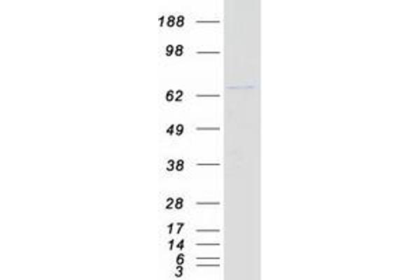 DDX41 Protein (Myc-DYKDDDDK Tag)