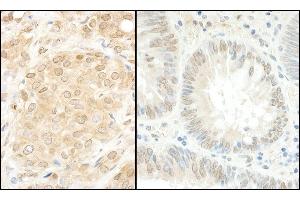 Immunohistochemistry (IHC) image for anti-Mitogen-Activated Protein Kinase Kinase 1 (MAP2K1) (AA 343-393) antibody (ABIN7454548)