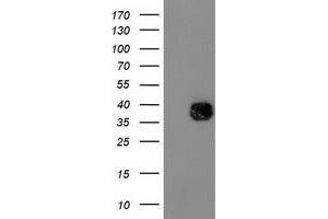 Western Blotting (WB) image for anti-NudE Nuclear Distribution E Homolog (A. Nidulans)-Like 1 (NDEL1) antibody (ABIN1499856) (NDEL1 抗体)