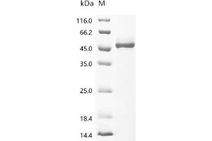 (Tris-Glycine gel) Discontinuous SDS-PAGE (reduced) with 5 % enrichment gel and 15 % separation gel.