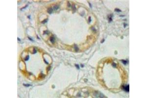 Used in DAB staining on fromalin fixed paraffin-embedded Kidney tissue (EPHA1 抗体  (AA 716-960))