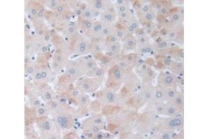 IHC-P analysis of Human Tissue, with DAB staining. (PPARD 抗体  (AA 260-426))